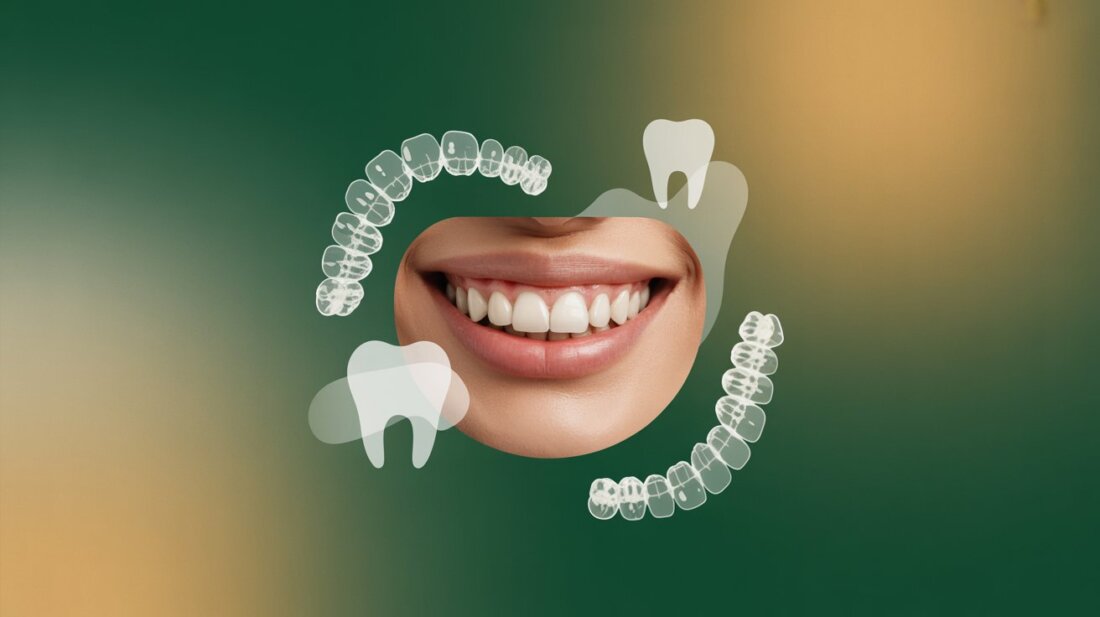 Tipos de Tratamiento de Ortodoncia
